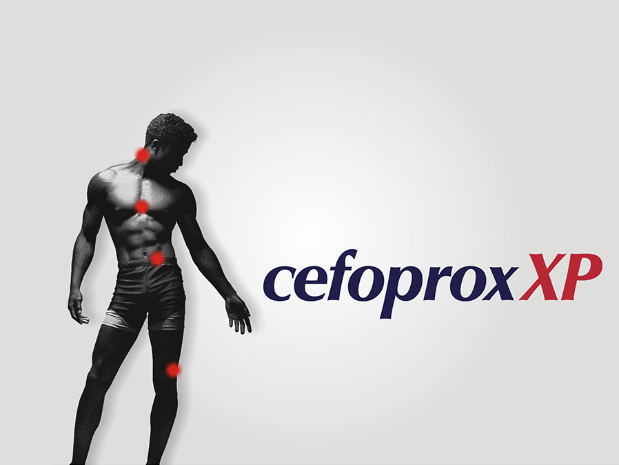 Logo Design - CefoproxXP